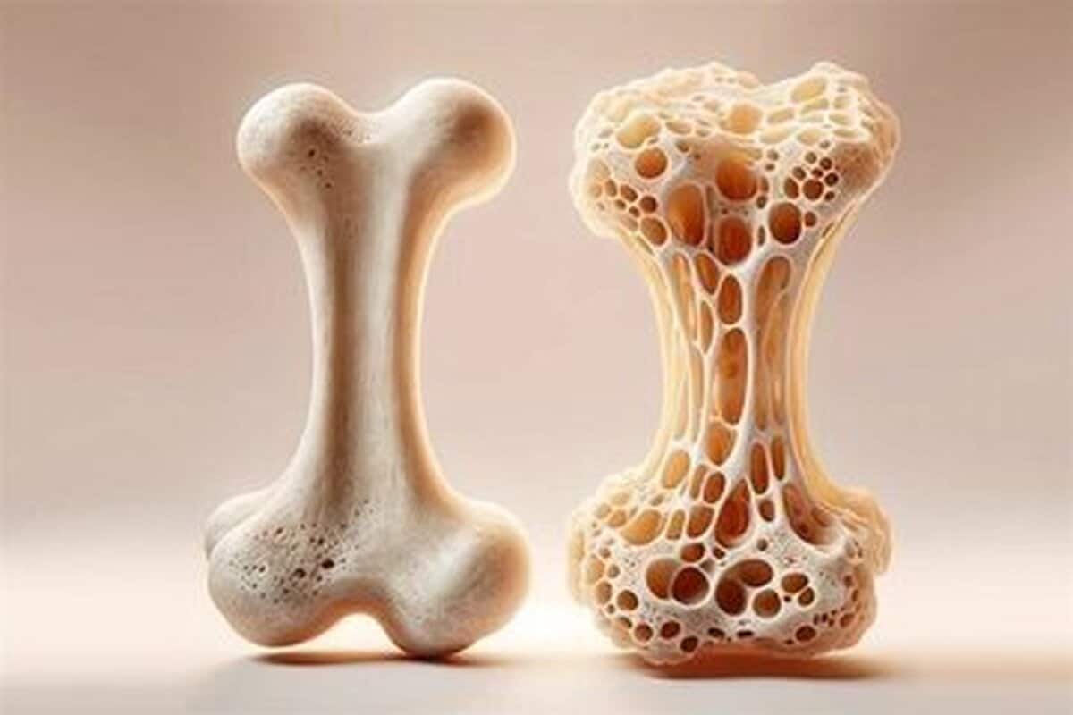 نجات استخوان‌ها از پوکی به‌کمک این مواد معدنی